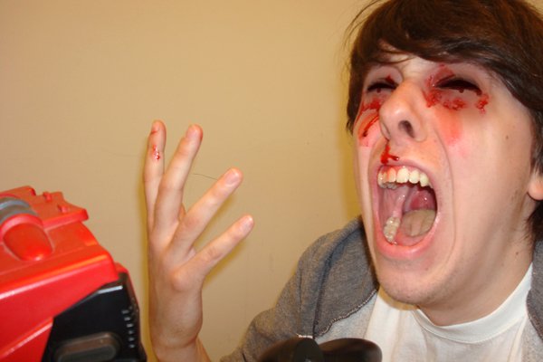 Now with added dizziness, loss of awareness, eyestrain, headaches, disorientation, backache, and shoulder pain